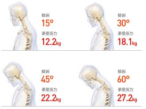 頸椎僵硬怎么辦？三步告別頸椎煩惱